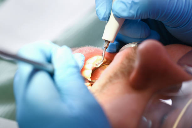 Best Emergency Dental Care for Sports Injuries in Lenox, IA